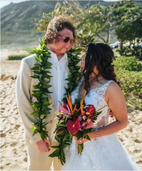婚：与大他12岁的护士网上相识婚礼还有粉丝道贺pg电子免费模拟器全球首例同时换脸换手男子结(图4)